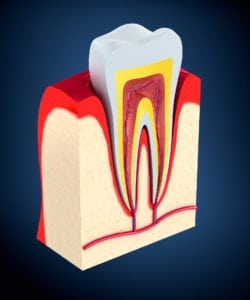 periodontal therapy