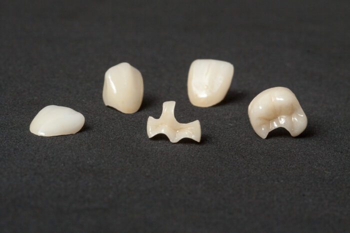 Inlays, onlays, and dental crowns each offer distinct advantages and are suited for different levels of tooth damage.